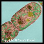 Cyanobacterium - Nostoc spp. Cyanobacterium - Nostoc spp.