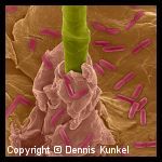 Escherichia coli Escherichia coli