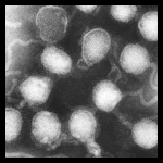 La Crosse encephalitis virus La Crosse encephalitis virus